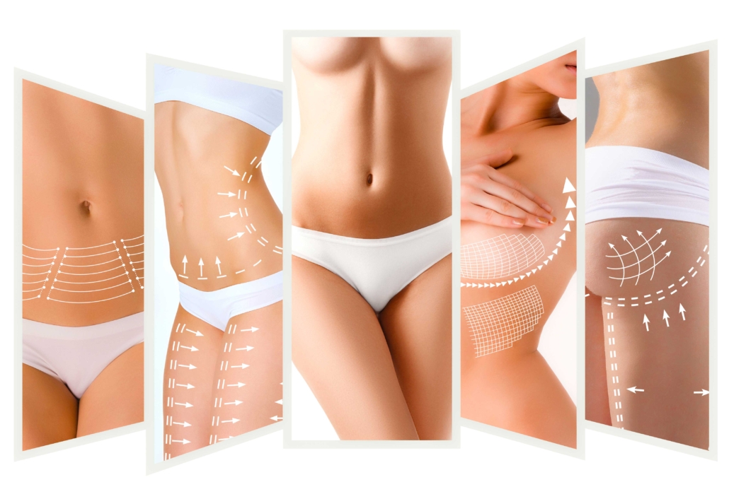 Cosmetic Surgery Graphic